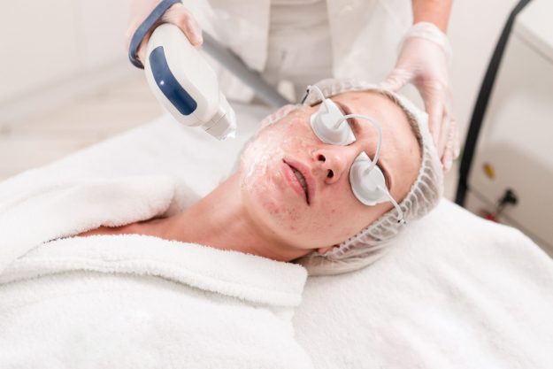 Anti acne phototherapy