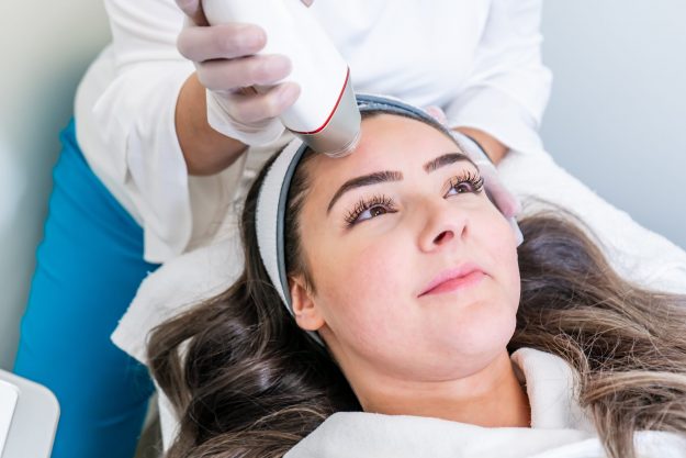 MICRONEEDLING