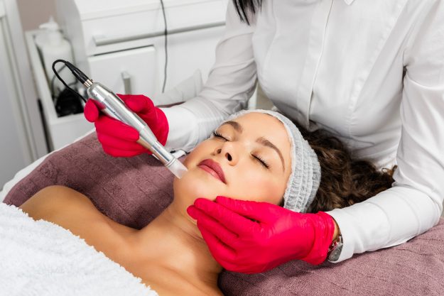 MICRONEEDLING WITH PRP “VAMPIRE”