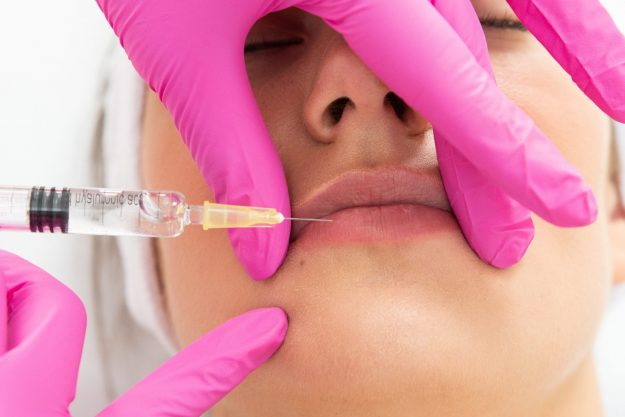 Juvederm Volbella