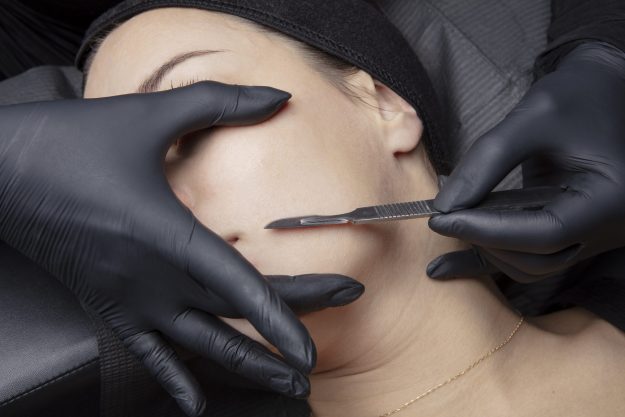 Dermaplaning
