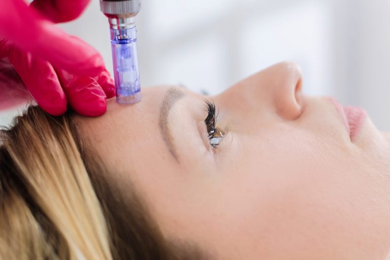 Do Microneedle facial rollers Work? Indulge Aesthetics